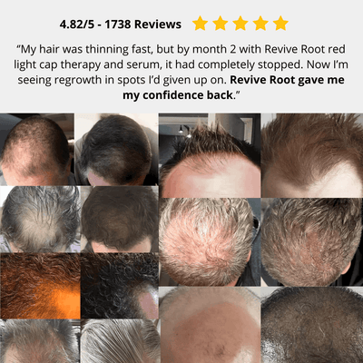 Red Light Therapy Cap for Hair Regrowth Treatments