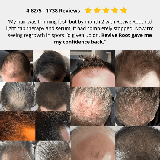 Red Light Therapy Cap for Hair Regrowth Treatments
